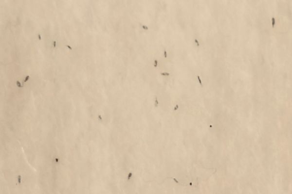 How Do I Know If My Child Has Head Lice?